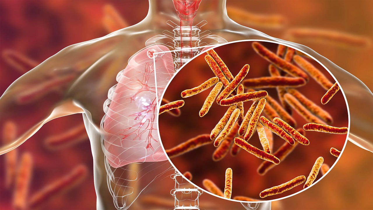 Strengthening Tuberculosis Care in India